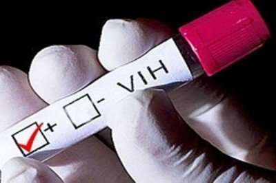 Un diagnóstico temprano de VIH garantiza vida para las personas infectadas de SIDA